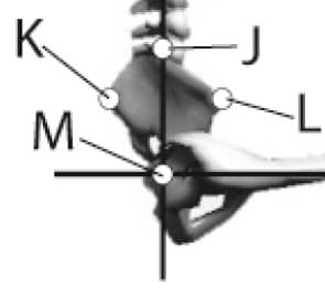 Alignment of pelvis fig 2