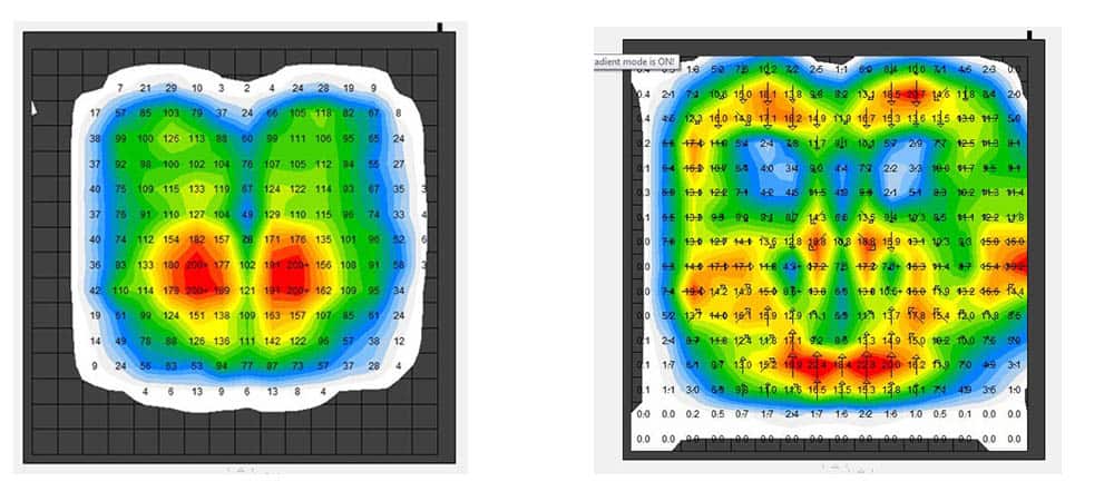 Figure 5. Pressure map showing left: pressures, with highest pressures under the ITs, and right: the gradients from the same map, showing greatest gradients are occurring around the sacral/coccyx area image